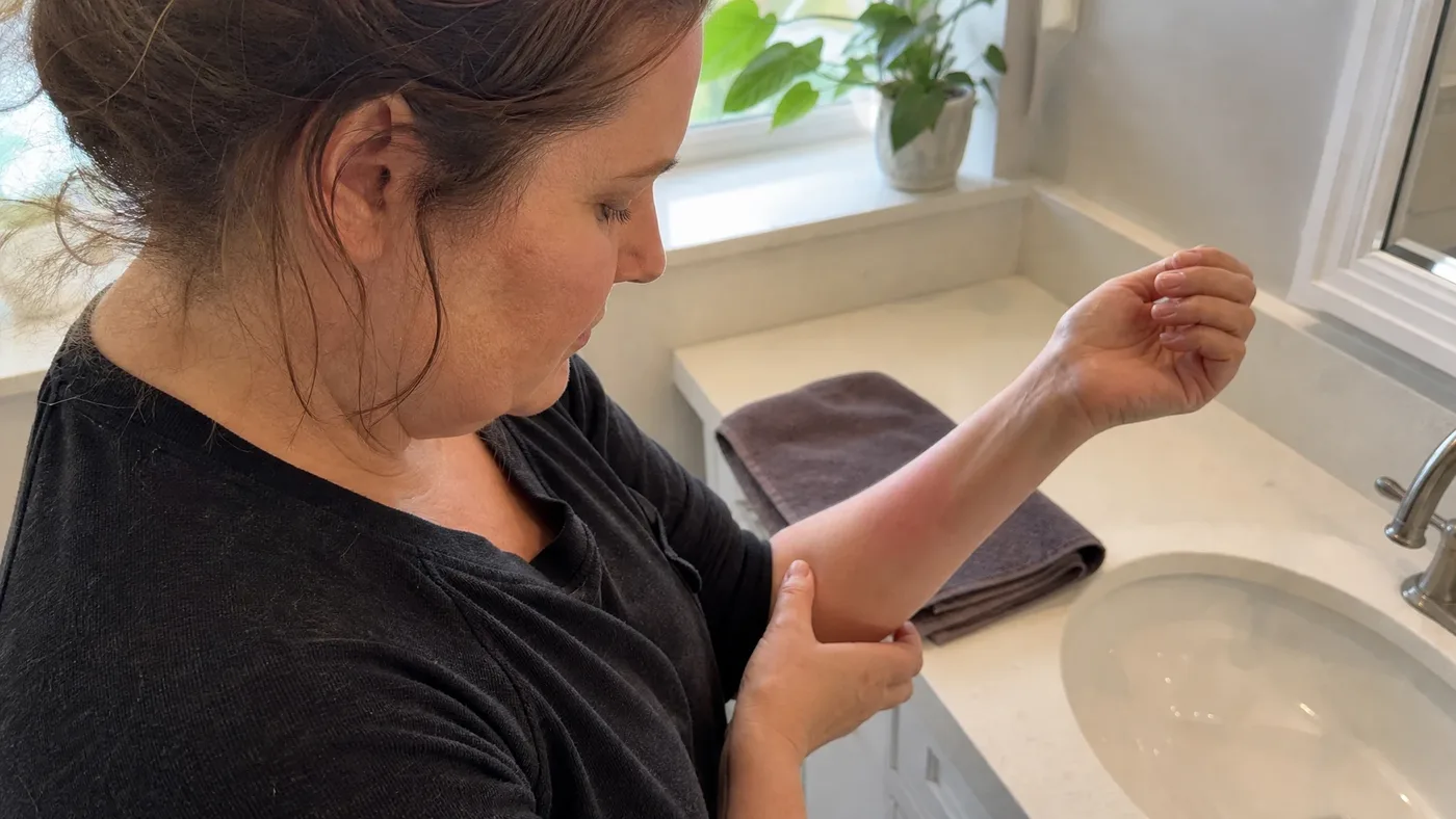 Clove Oil Side Effects: Skin, Allergy, Blood and Swallowing